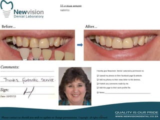 I hereby give Newvision Dental Laboratory permission to:

 Upload my photos to their facebook page & website.
 Add my photos to their news letter to the dentists.
 Publish any comments made by me.
 Add this page to their work profile file.
 Notes:______________________________________________

 