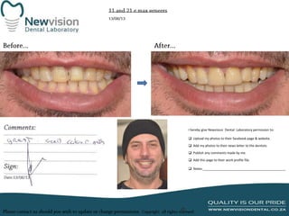 I hereby give Newvision Dental Laboratory permission to:
 Upload my photos to their facebook page & website.
 Add my photos to their news letter to the dentists.
 Publish any comments made by me.
 Add this page to their work profile file.
 Notes:______________________________________________

 
