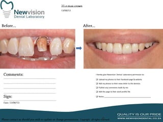 I hereby give Newvision Dental Laboratory permission to:
 Upload my photos to their facebook page & website.
 Add my photos to their news letter to the dentists.
 Publish any comments made by me.
 Add this page to their work profile file.
 Notes:______________________________________________

 
