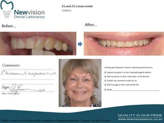 I hereby give Newvision Dental Laboratory permission to:
 Upload my photo’s to their facebook page & website.

 Add my photo’s to their news letter to the dentists.
 Publish any comments made by me.
 Add this page to their work profile file.
 Notes:______________________________________________

 