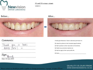 I hereby give Newvision Dental Laboratory permission to:
 Upload my photos to their facebook page & website.
 Add my photos to their news letter to the dentists.

 Publish any comments made by me.
 Add this page to their work profile file.
 Notes:______________________________________________

 