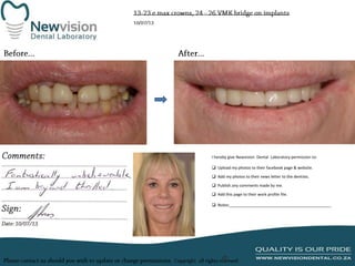 I hereby give Newvision Dental Laboratory permission to:

 Upload my photos to their facebook page & website.
 Add my photos to their news letter to the dentists.
 Publish any comments made by me.
 Add this page to their work profile file.
 Notes:______________________________________________

 