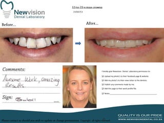I hereby give Newvision Dental Laboratory permission to:
 Upload my photo’s to their facebook page & website.
 Add my photo’s to their news letter to the dentists.

 Publish any comments made by me.
 Add this page to their work profile file.
 Notes:______________________________________________

 