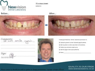 I hereby give Newvision Dental Laboratory permission to:
 Upload my photo’s to their facebook page & website.
 Add my photo’s to their news letter to the dentists.
 Publish any comments made by me.
 Add this page to their work profile file.
 Notes:______________________________________________

 
