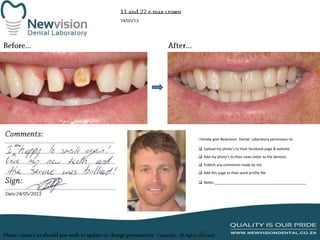I hereby give Newvision Dental Laboratory permission to:
 Upload my photo’s to their facebook page & website.
 Add my photo’s to their news letter to the dentists.

 Publish any comments made by me.
 Add this page to their work profile file.
 Notes:______________________________________________

 