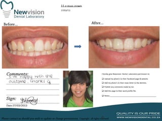 I hereby give Newvision Dental Laboratory permission to:
 Upload my photo’s to their facebook page & website.
 Add my photo’s to their news letter to the dentists.
 Publish any comments made by me.
 Add this page to their work profile file.
 Notes:______________________________________________

 