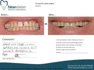 I hereby give Newvision Dental Laboratory permission to:
 Upload my photo’s to their facebook page & website.
 Add my photo’s to their news letter to the dentists.
 Publish any comments made by me.
 Add this page to their work profile file.
 Notes:______________________________________________

 