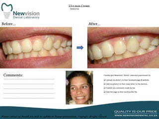 I hereby give Newvision Dental Laboratory permission to:
 Upload my photo’s to their facebook page & website.
 Add my photo’s to their news letter to the dentists.
 Publish any comments made by me.
 Add this page to their work profile file.

 