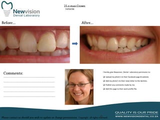 I hereby give Newvision Dental Laboratory permission to:
 Upload my photo’s to their facebook page & website.
 Add my photo’s to their news letter to the dentists.
 Publish any comments made by me.
 Add this page to their work profile file.

 