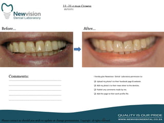 I hereby give Newvision Dental Laboratory permission to:
 Upload my photo’s to their facebook page & website.
 Add my photo’s to their news letter to the dentists.
 Publish any comments made by me.
 Add this page to their work profile file.

 