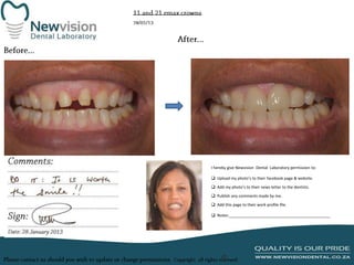 I hereby give Newvision Dental Laboratory permission to:
 Upload my photo’s to their facebook page & website.
 Add my photo’s to their news letter to the dentists.
 Publish any comments made by me.
 Add this page to their work profile file.
 Notes:______________________________________________

 