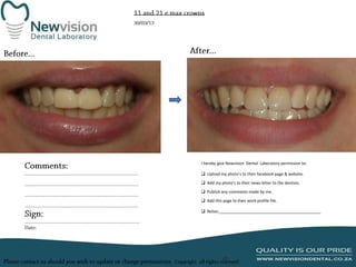 I hereby give Newvision Dental Laboratory permission to:
 Upload my photo’s to their facebook page & website.
 Add my photo’s to their news letter to the dentists.
 Publish any comments made by me.
 Add this page to their work profile file.
 Notes:______________________________________________

 