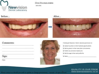 I hereby give Newvision Dental Laboratory permission to:
 Upload my photo’s to their facebook page & website.
 Add my photo’s to their news letter to the dentists.

 Publish any comments made by me.
 Add this page to their work profile file.
 Notes:______________________________________________

 
