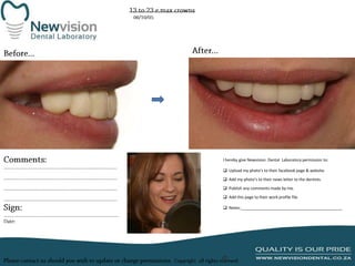 I hereby give Newvision Dental Laboratory permission to:
 Upload my photo’s to their facebook page & website.
 Add my photo’s to their news letter to the dentists.
 Publish any comments made by me.
 Add this page to their work profile file.
 Notes:______________________________________________

 