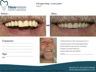 I hereby give Newvision Dental Laboratory permission to:
 Upload my photo’s to their facebook page & website.
 Add my photo’s to their news letter to the dentists.
 Publish any comments made by me.
 Add this page to their work profile file.
 Notes:______________________________________________

 