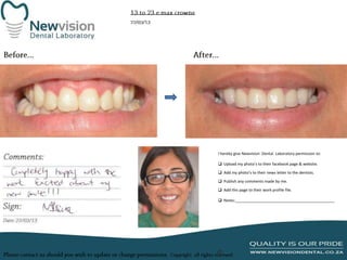I hereby give Newvision Dental Laboratory permission to:

 Upload my photo’s to their facebook page & website.
 Add my photo’s to their news letter to the dentists.
 Publish any comments made by me.
 Add this page to their work profile file.
 Notes:______________________________________________

 