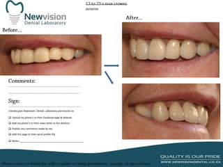 I hereby give Newvision Dental Laboratory permission to:
 Upload my photo’s to their facebook page & website.
 Add my photo’s to their news letter to the dentists.
 Publish any comments made by me.
 Add this page to their work profile file.
 Notes:______________________________________________

 
