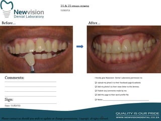I hereby give Newvision Dental Laboratory permission to:
 Upload my photo’s to their facebook page & website.
 Add my photo’s to their news letter to the dentists.
 Publish any comments made by me.
 Add this page to their work profile file.
 Notes:______________________________________________

 