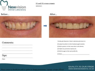 I hereby give Newvision Dental Laboratory permission to:
 Upload my photo’s to their facebook page & website.
 Add my photo’s to their news letter to the dentists.

 Publish any comments made by me.
 Add this page to their work profile file.
 Notes:______________________________________________

 
