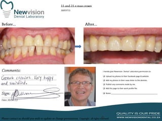 I hereby give Newvision Dental Laboratory permission to:

 Upload my photos to their facebook page & website.
 Add my photos to their news letter to the dentists.
 Publish any comments made by me.
 Add this page to their work profile file.
 Notes:______________________________________________

 