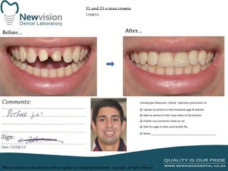 I hereby give Newvision Dental Laboratory permission to:
 Upload my photos to their facebook page & website.
 Add my photos to their news letter to the dentists.
 Publish any comments made by me.
 Add this page to their work profile file.
 Notes:______________________________________________

 