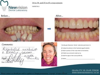 I hereby give Newvision Dental Laboratory permission to:
 Upload my photos to their facebook page & website.
 Add my photos to their news letter to the dentists.
 Publish any comments made by me.
 Add this page to their work profile file.
 Notes:______________________________________________

 