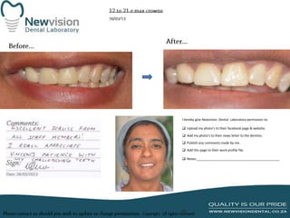 I hereby give Newvision Dental Laboratory permission to:
 Upload my photo’s to their facebook page & website.

 Add my photo’s to their news letter to the dentists.
 Publish any comments made by me.
 Add this page to their work profile file.
 Notes:______________________________________________

 