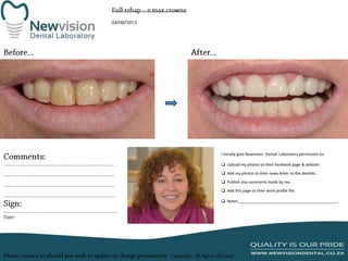 I hereby give Newvision Dental Laboratory permission to:

 Upload my photos to their facebook page & website.
 Add my photos to their news letter to the dentists.
 Publish any comments made by me.
 Add this page to their work profile file.
 Notes:______________________________________________

 