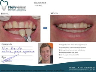 I hereby give Newvision Dental Laboratory permission to:
 Upload my photos to their facebook page & website.
 Add my photos to their news letter to the dentists.
 Publish any comments made by me.
 Add this page to their work profile file.
 Notes:______________________________________________

 