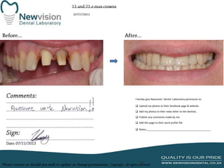 I hereby give Newvision Dental Laboratory permission to:

 Upload my photos to their facebook page & website.
 Add my photos to their news letter to the dentists.
 Publish any comments made by me.
 Add this page to their work profile file.
 Notes:______________________________________________

 
