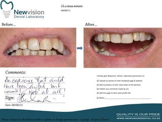 I hereby give Newvision Dental Laboratory permission to:
 Upload my photos to their facebook page & website.
 Add my photos to their news letter to the dentists.
 Publish any comments made by me.
 Add this page to their work profile file.
 Notes:______________________________________________

 