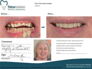 I hereby give Newvision Dental Laboratory permission to:

 Upload my photo’s to their facebook page & website.
 Add my photo’s to their news letter to the dentists.
 Publish any comments made by me.
 Add this page to their work profile file.
 Notes:______________________________________________

 