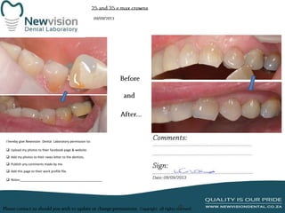 I hereby give Newvision Dental Laboratory permission to:
 Upload my photos to their facebook page & website.
 Add my photos to their news letter to the dentists.
 Publish any comments made by me.
 Add this page to their work profile file.
 Notes:______________________________________________

 