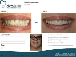 I hereby give Newvision Dental Laboratory permission to:
 Upload my photos to their facebook page & website.
 Add my photos to their news letter to the dentists.
 Publish any comments made by me.
 Add this page to their work profile file.
 Notes:______________________________________________

 