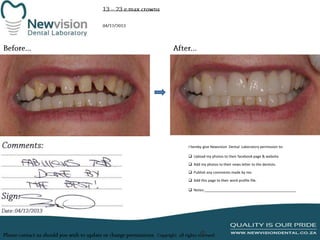 I hereby give Newvision Dental Laboratory permission to:
 Upload my photos to their facebook page & website.
 Add my photos to their news letter to the dentists.
 Publish any comments made by me.
 Add this page to their work profile file.
 Notes:______________________________________________

 