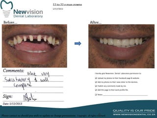 I hereby give Newvision Dental Laboratory permission to:
 Upload my photos to their facebook page & website.
 Add my photos to their news letter to the dentists.
 Publish any comments made by me.
 Add this page to their work profile file.
 Notes:______________________________________________

 