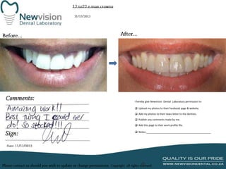 I hereby give Newvision Dental Laboratory permission to:
 Upload my photos to their facebook page & website.
 Add my photos to their news letter to the dentists.
 Publish any comments made by me.
 Add this page to their work profile file.
 Notes:______________________________________________

 