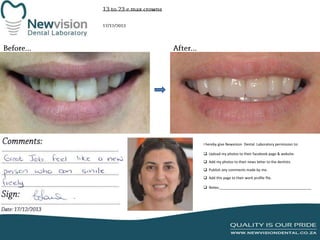 I hereby give Newvision Dental Laboratory permission to:
 Upload my photos to their facebook page & website.
 Add my photos to their news letter to the dentists.
 Publish any comments made by me.
 Add this page to their work profile file.
 Notes:______________________________________________

 