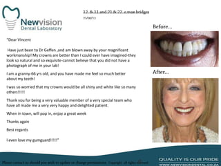 “Dear Vincent
Have just been to Dr Geffen ,and am blown away by your magnificent
workmanship! My crowns are better than I could ever have imagined-they
look so natural and so exquisite-cannot believe that you did not have a
photograph of me in your lab!
I am a granny-66 yrs old, and you have made me feel so much better
about my teeth!
I was so worried that my crowns would be all shiny and white like so many
others!!!!!
Thank you for being a very valuable member of a very special team who
have all made me a very very happy and delighted patient.
When in town, will pop in, enjoy a great week
Thanks again
Best regards
I even love my gumguard!!!!!”

 