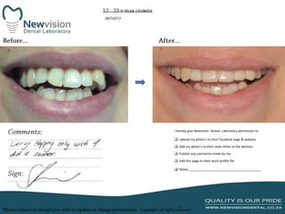 I hereby give Newvision Dental Laboratory permission to:
 Upload my photo’s to their facebook page & website.
 Add my photo’s to their news letter to the dentists.
 Publish any comments made by me.
 Add this page to their work profile file.
 Notes:_________________________________________

 