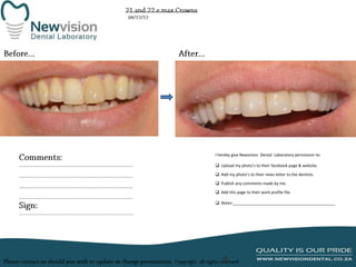I hereby give Newvision Dental Laboratory permission to:
 Upload my photo’s to their facebook page & website.
 Add my photo’s to their news letter to the dentists.

 Publish any comments made by me.
 Add this page to their work profile file.
 Notes:______________________________________________

 