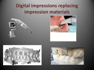 Digital impressions replacing
impression materials
 