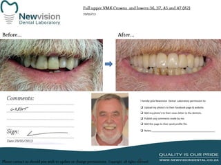 I hereby give Newvision Dental Laboratory permission to:
 Upload my photo’s to their facebook page & website.
 Add my photo’s to their news letter to the dentists.
 Publish any comments made by me.
 Add this page to their work profile file.
 Notes:______________________________________________

 