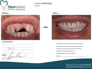 I hereby give Newvision Dental Laboratory permission to:
 Upload my photos to their facebook page & website.
 Add my photos to their news letter to the dentists.
 Publish any comments made by me.
 Add this page to their work profile file.
 Notes:______________________________________________

 