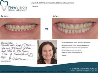 I hereby give Newvision Dental Laboratory permission to:
 Upload my photos to their facebook page & website.
 Add my photos to their news letter to the dentists.

 Publish any comments made by me.
 Add this page to their work profile file.
 Notes:______________________________________________

 