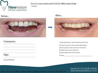 I hereby give Newvision Dental Laboratory permission to:
 Upload my photos to their facebook page & website.
 Add my photos to their news letter to the dentists.

 Publish any comments made by me.
 Add this page to their work profile file.
 Notes:______________________________________________

 