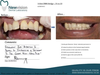 I hereby give Newvision Dental Laboratory permission to:

 Upload my photos to their facebook page & website.
 Add my photos to their news letter to the dentists.
 Publish any comments made by me.
 Add this page to their work profile file.
 Notes:______________________________________________

 