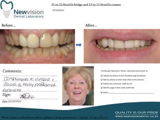 I hereby give Newvision Dental Laboratory permission to:

 Upload my photos to their facebook page & website.
 Add my photos to their news letter to the dentists.
 Publish any comments made by me.
 Add this page to their work profile file.
 Notes:______________________________________________

 