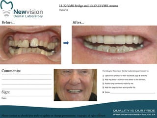 I hereby give Newvision Dental Laboratory permission to:
 Upload my photo’s to their facebook page & website.
 Add my photo’s to their news letter to the dentists.
 Publish any comments made by me.
 Add this page to their work profile file.
 Notes:______________________________________________

 