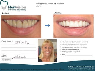 I hereby give Newvision Dental Laboratory permission to:

 Upload my photos to their facebook page & website.
 Add my photo’s to their news letter to the dentists.
 Publish any comments made by me.
 Add this page to their work profile file.
 Notes:______________________________________________

 